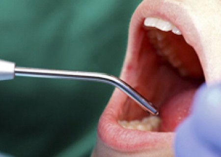 Dental Implants in Pune India
